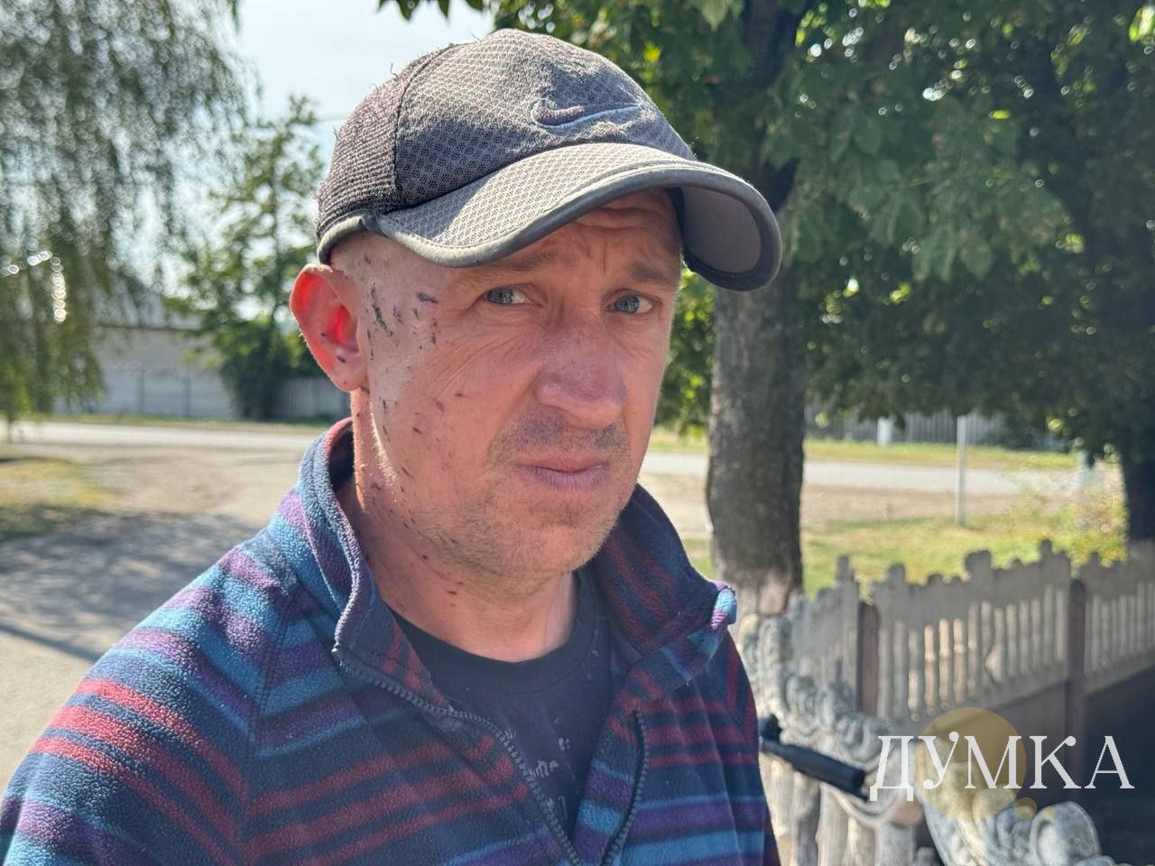 Пострадавший во время обстрела работник "Зеленстроя" Александр