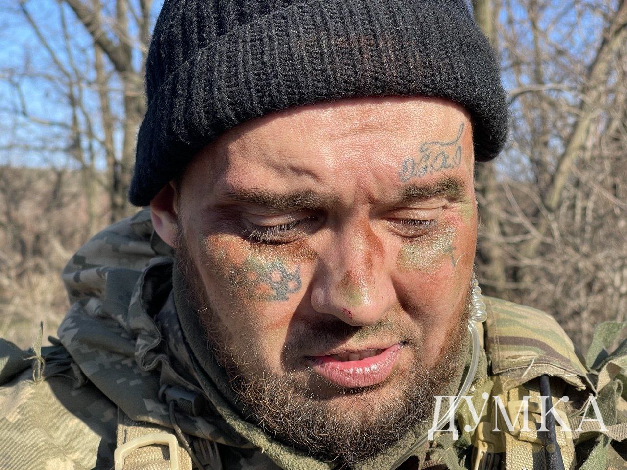 Військовослужбовець 93 бригади, позивний "Кабан", після УДЗ, лютий 2025 року / Фото: Думка