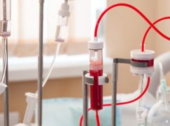 МОЗ обрало дві лікарні в Харкові, де безкоштовно очищатимуть кров