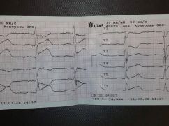 В Харьковской области медики скорой вытащили из того света 72-летнюю женщину