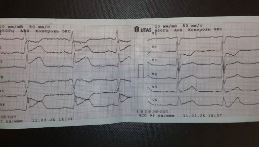 В Харьковской области медики экстренки вытащили из того мира 72-летнюю женщину