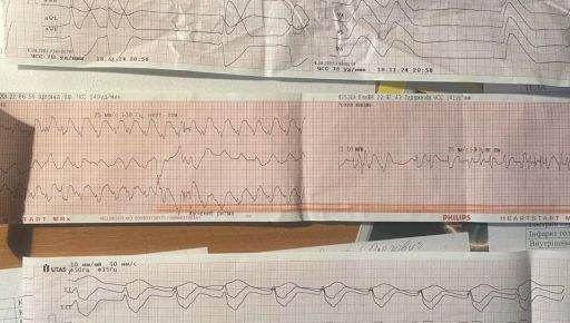 "Швидка" повернула до життя харків’янку після клінічної смерті
