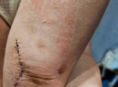 Адвокатка, яку побили у харківському ТЦК, отримала інвалідність &ndash; омбудсмен