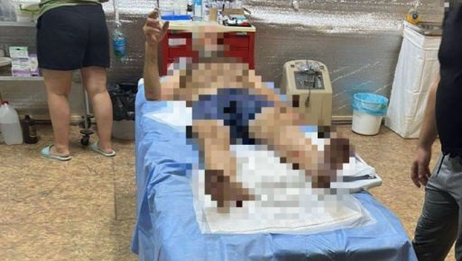 У Куп’янську російські військові обстріляли з автомата 74-річного велосипедиста