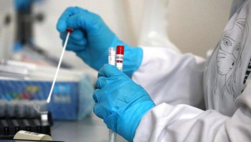 Известный харьковский иммунолог назвал причину вспышки гепатита А в Украине