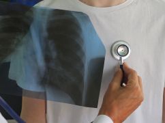 В Харьковской области выросла заболеваемость туберкулезом среди детей: что известно