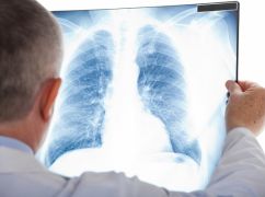 На Харківщині захворюваність туберкульозом зросла у 2,3 рази